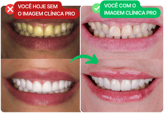 Comparativo de registros clínicos padronizados